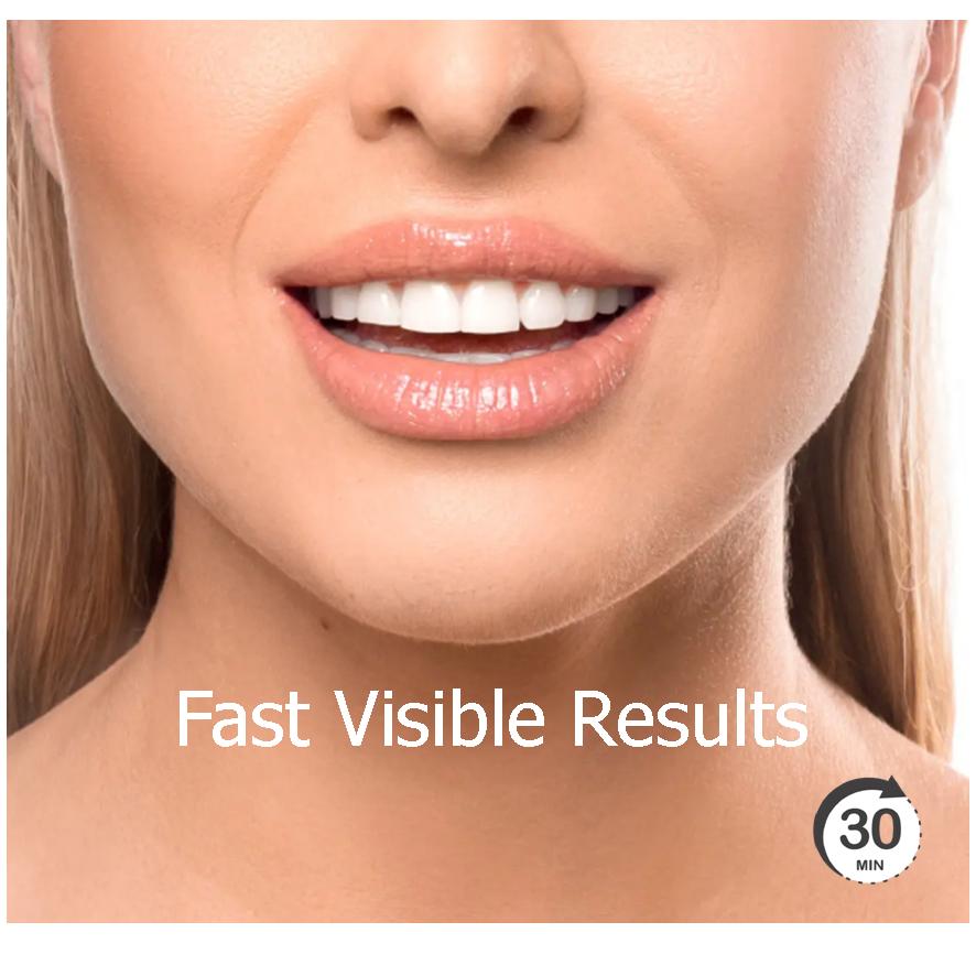 Teeth Whitening Gel 3ml each, Refill Gels Bleach fast effective whitener for excellent results