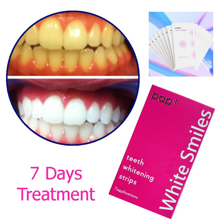 Teeth Whitening Strips 7 Pairs, 7 days supply. PAP WHITE SMILES Processional Dental Whitening Bleach