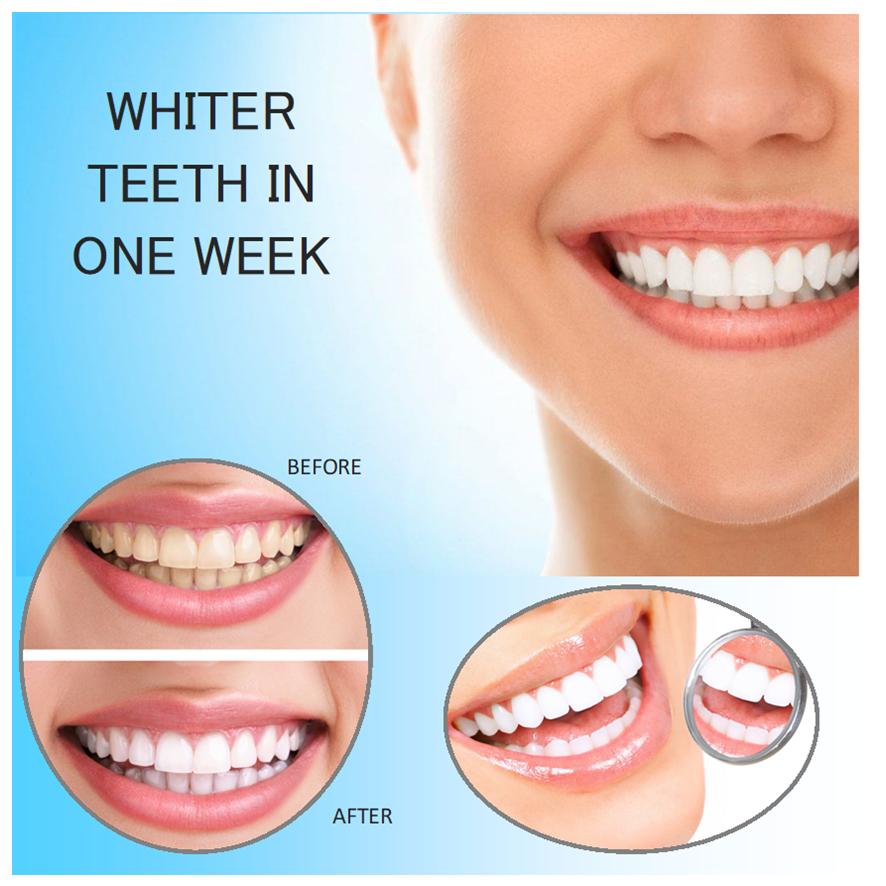 Teeth Whitening Gel Made in Italy Refill Gel 10ml, Fast amazing results