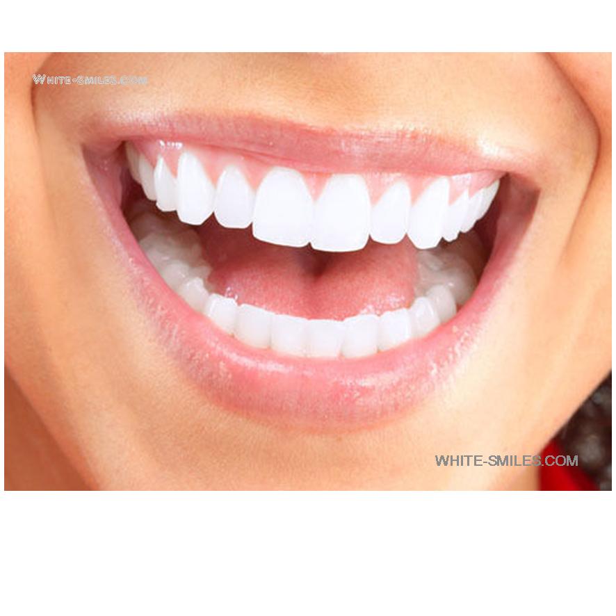 REMINERALISING GEL 3 REMINERALIZING REMINERALISATION GELS TEETH WHITENING