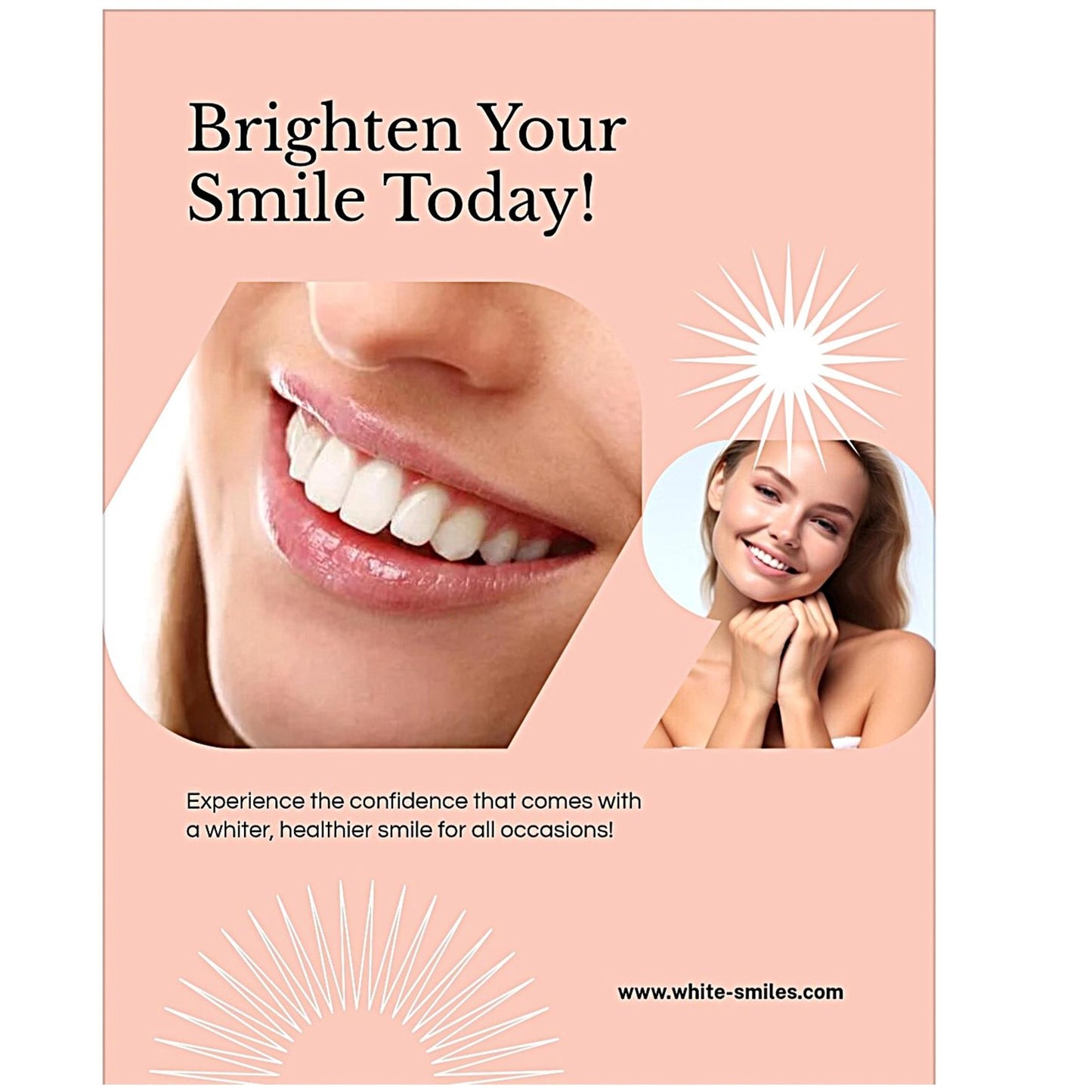Teeth Whitening Refill Gel 10ml, Made in Italy