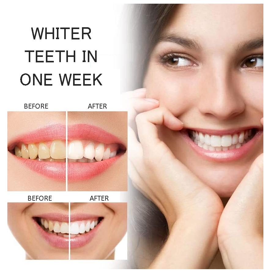Teeth Whitening Refill Gel 10ml Made in USA, fast effective whitening